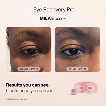 Eye Recovery Pro Kit™ — Anti-Aging LED Eye Mask