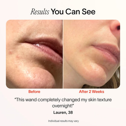 RadiantWand™ – 4-in-1 glow-boosting skincare renewal