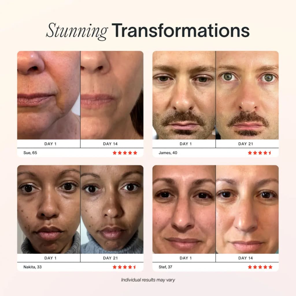 RadiantWand™ – 4-in-1 glow-boosting skincare renewal