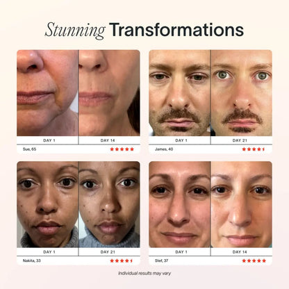 RadiantWand™ – 4-in-1 glow-boosting skincare renewal