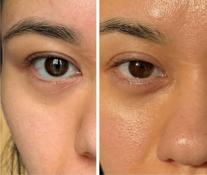 Eye Recovery Pro Kit™ — Anti-Aging LED Eye Mask