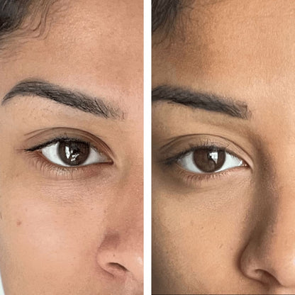 Eye Recovery Pro Kit™ — Anti-Aging LED Eye Mask